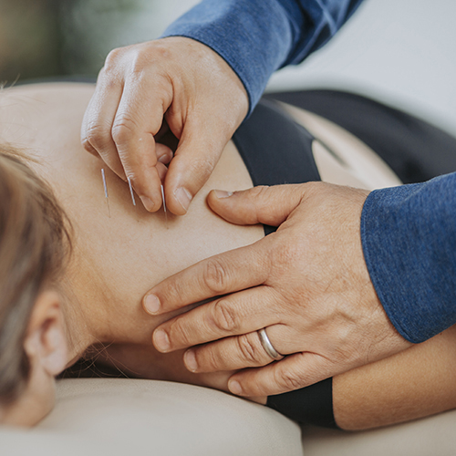 Durchführung einer TCM-Behandlung mit Akupunktur